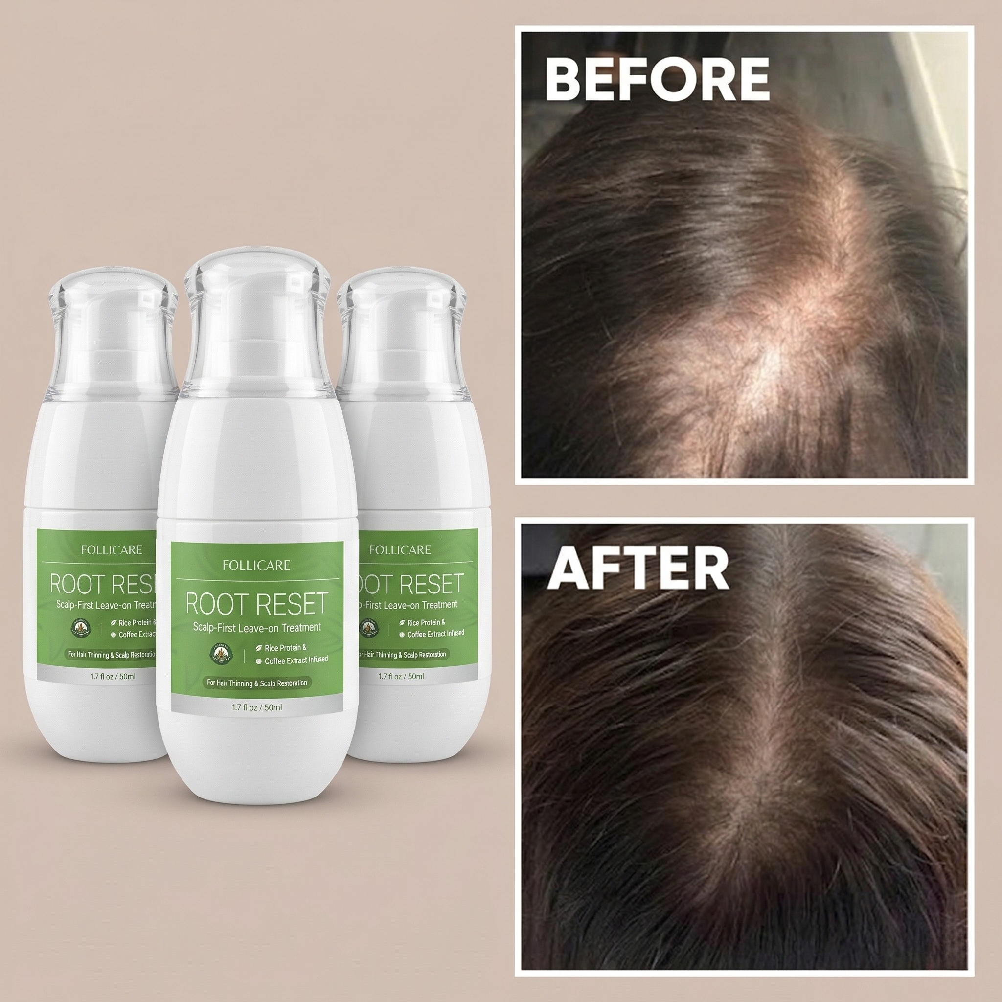 Follicare Root Reset — Scalp-First Leave-On Treatment